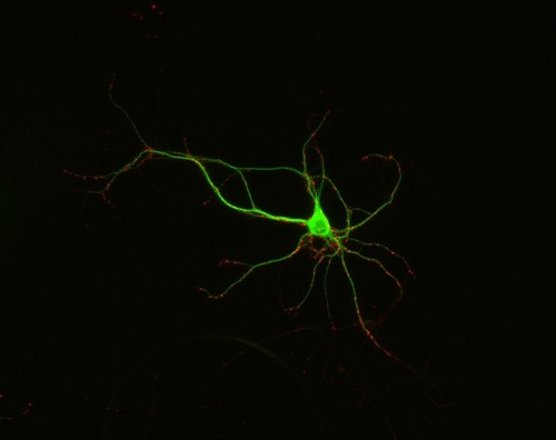 CIL:12565, Rattus, multipolar neuron