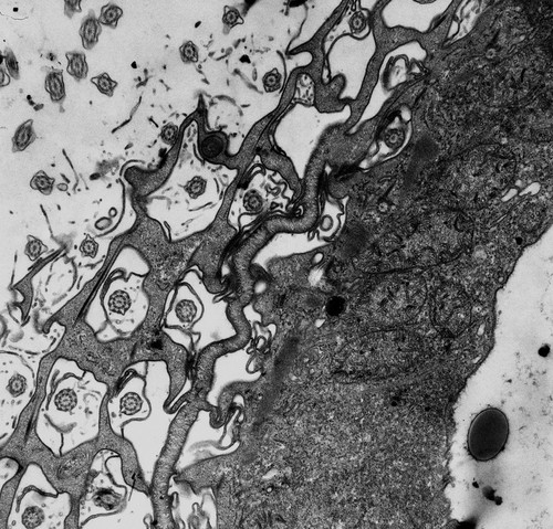 CIL:12343, Paramecium multimicronucleatum, cell by organism, eukaryotic cell, Eukaryotic Protist, Ciliated Protist