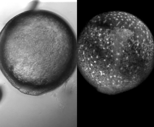 CIL:11811, Danio rerio, yolk cell