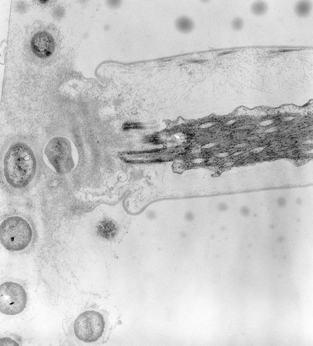 CIL:39512, Vorticella convallaria, cell by organism, eukaryotic cell, Eukaryotic Protist, Ciliated Protist