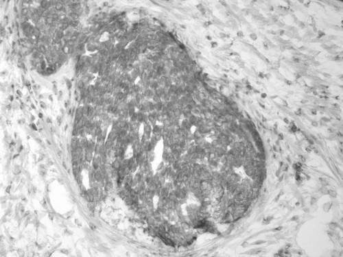 CIL:33628, Homo sapiens, endocrine-paracrine cell of prostate gland, basal cell of prostate epithelium, luminal cell of prostate epithelium, blood vessel endothelial cell, perineural cell, sheath cell, leukocyte, prostate stromal cell, smooth muscle cell of prostate