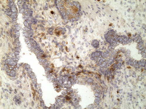 CIL:32552, Homo sapiens, endocrine-paracrine cell of prostate gland, basal cell of prostate epithelium, luminal cell of prostate epithelium, blood vessel endothelial cell, perineural cell, sheath cell, leukocyte, prostate stromal cell, smooth muscle cell of prostate