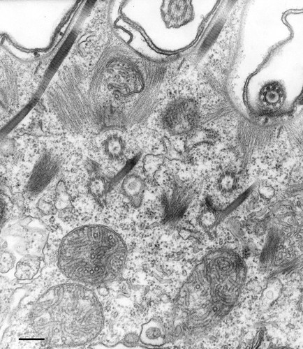 CIL:36632, Paramecium multimicronucleatum, cell by organism, eukaryotic cell, Eukaryotic Protist, Ciliated Protist