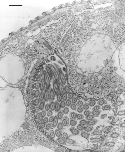 CIL:9922, Opercularia [NCBITaxon:168247], Opercularia coarctata, cell by organism, eukaryotic cell, Eukaryotic Protist, Ciliated Protist