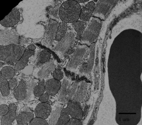 CIL:39759, Mus musculus, cardiac muscle cell