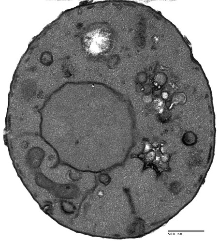 CIL:40434, Saccharomyces cerevisiae, sac1∆ mutant