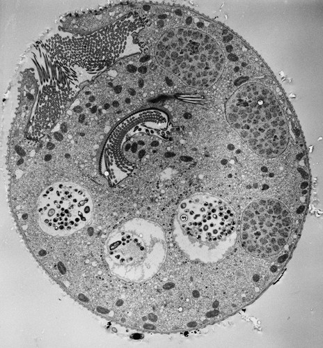 CIL:39408, Vorticella convallaria, cell by organism, eukaryotic cell, Eukaryotic Protist, Ciliated Protist