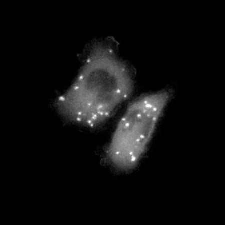 CIL:25705, Rattus, mammary adenocarcinoma