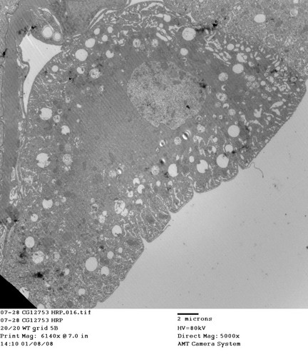 CIL:13470, Drosophila melanogaster, garland cell