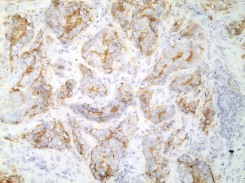 CIL:33487, Homo sapiens, endocrine-paracrine cell of prostate gland, basal cell of prostate epithelium, luminal cell of prostate epithelium, blood vessel endothelial cell, perineural cell, sheath cell, leukocyte, prostate stromal cell, smooth muscle cell of prostate