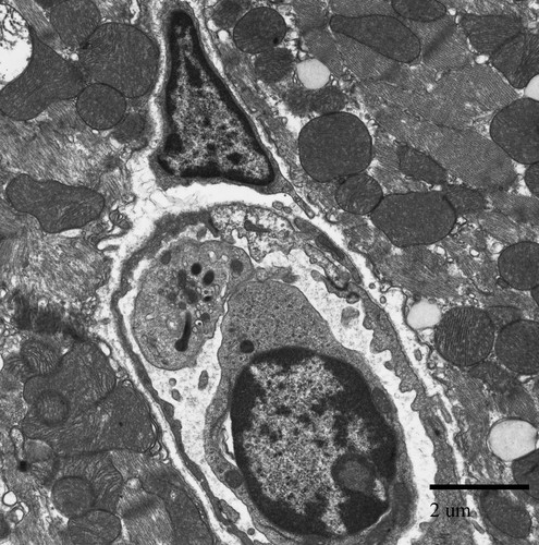 CIL:39756, Mus musculus, blood cell, cardiac muscle cell, blood vessel endothelial cell