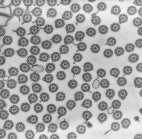 CIL:39240, uncultured scuticociliate, Conchophthirus curtus, cell by organism, eukaryotic cell, Eukaryotic Protist, Ciliated Protist