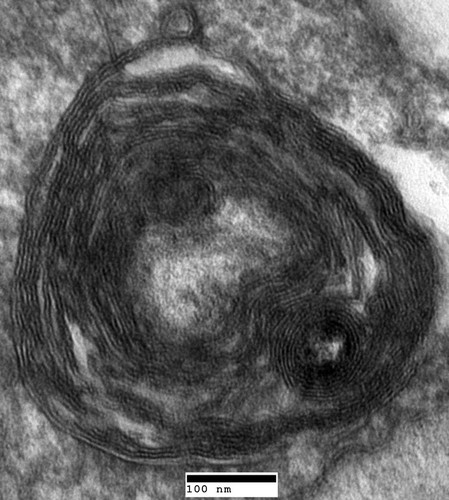 CIL:40428, Saccharomyces cerevisiae, vma9 mutant