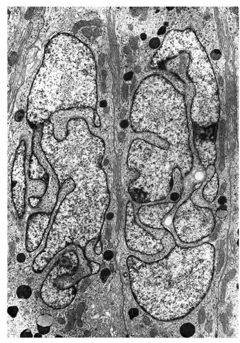 CIL:10973, Chinchilla, epithelial cell