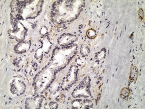 CIL:32543, Homo sapiens, endocrine-paracrine cell of prostate gland, basal cell of prostate epithelium, luminal cell of prostate epithelium, blood vessel endothelial cell, perineural cell, sheath cell, leukocyte, prostate stromal cell, smooth muscle cell of prostate