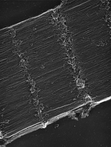 CIL:35971, damselfly, flight muscle cell