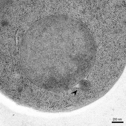 CIL: 50819, Saccharomyces cerevisiae (baker's yeast, budding yeast), Mixed population of S. cerevisiae cells