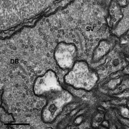 CIL:6519, Danio rerio, Outer plexiform layer of retina