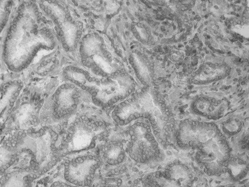 CIL:33595, Homo sapiens, endocrine-paracrine cell of prostate gland, basal cell of prostate epithelium, luminal cell of prostate epithelium, blood vessel endothelial cell, perineural cell, sheath cell, leukocyte, prostate stromal cell, smooth muscle cell of prostate