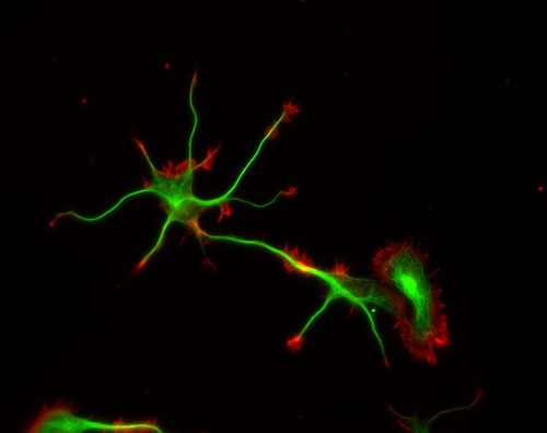 CIL:8788, Rattus, multipolar neuron