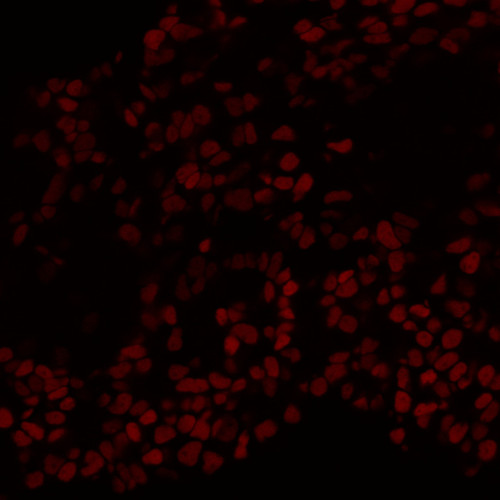 CIL: 54800, Homo sapiens, SBAD2 human iPSC line