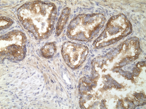 CIL:32188, Homo sapiens, endocrine-paracrine cell of prostate gland, basal cell of prostate epithelium, luminal cell of prostate epithelium, blood vessel endothelial cell, perineural cell, sheath cell, leukocyte, prostate stromal cell, smooth muscle cell of prostate