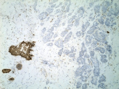 CIL:33110, Homo sapiens, endocrine-paracrine cell of prostate gland, basal cell of prostate epithelium, luminal cell of prostate epithelium, blood vessel endothelial cell, perineural cell, sheath cell, leukocyte, prostate stromal cell, smooth muscle cell of prostate