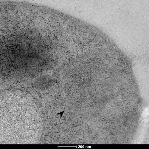 CIL: 50852, Saccharomyces cerevisiae (baker's yeast, budding yeast), Mixed population of S. cerevisiae cells