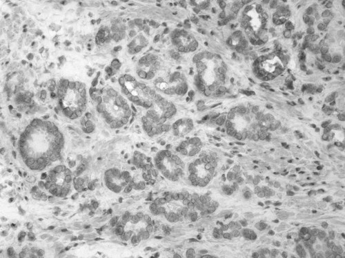 CIL:34178, Homo sapiens, endocrine-paracrine cell of prostate gland, basal cell of prostate epithelium, luminal cell of prostate epithelium, blood vessel endothelial cell, perineural cell, sheath cell, leukocyte, prostate stromal cell, smooth muscle cell of prostate