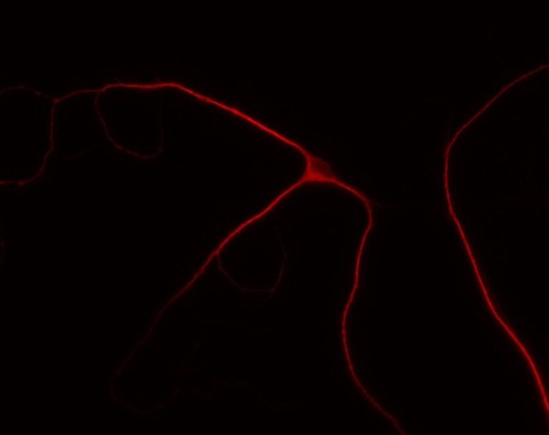 CIL:10356, Rattus, multipolar neuron