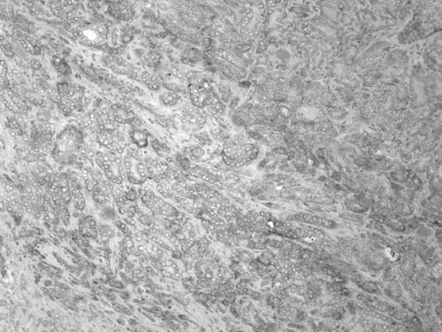 CIL:33605, Homo sapiens, endocrine-paracrine cell of prostate gland, basal cell of prostate epithelium, luminal cell of prostate epithelium, blood vessel endothelial cell, perineural cell, sheath cell, leukocyte, prostate stromal cell, smooth muscle cell of prostate