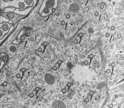 CIL:12031, Paramecium multimicronucleatum, cell by organism, eukaryotic cell, Eukaryotic Protist, Ciliated Protist