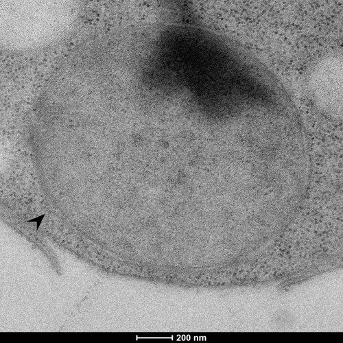 CIL: 50861, Saccharomyces cerevisiae (baker's yeast, budding yeast), Mixed population of S. cerevisiae cells