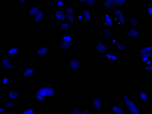 CIL: 54776, Homo sapiens, SBAD2 human iPSC line