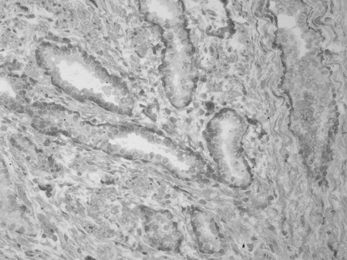 CIL:33613, Homo sapiens, endocrine-paracrine cell of prostate gland, basal cell of prostate epithelium, luminal cell of prostate epithelium, blood vessel endothelial cell, perineural cell, sheath cell, leukocyte, prostate stromal cell, smooth muscle cell of prostate