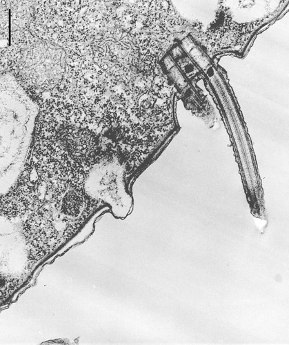 CIL:12104, Colpoda cucullus, cell by organism, eukaryotic cell, Eukaryotic Protist, Ciliated Protist