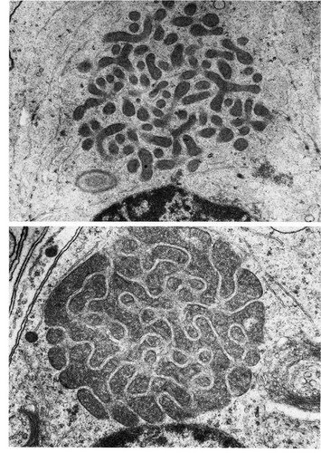 CIL:11422, unclassified Insecta, spermatid