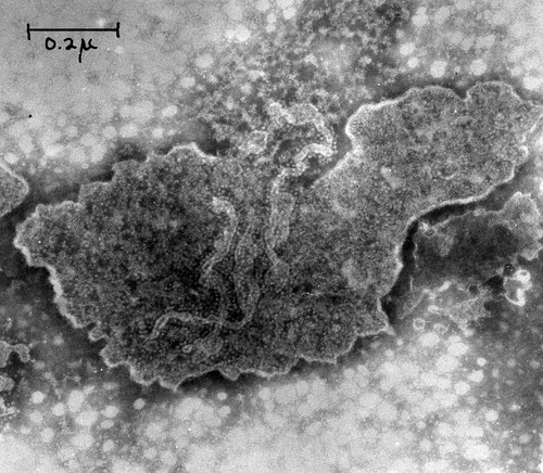 CIL:37195, Neurospora