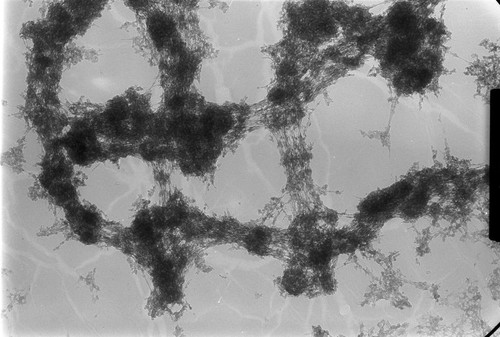 CIL:25404, Drosophila melanogaster, fat body cell