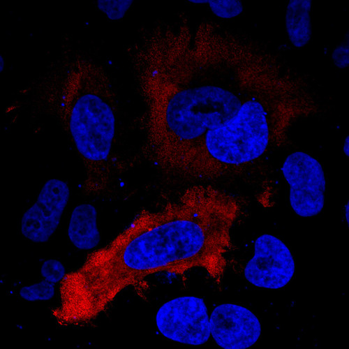 CIL: 53933, Homo sapiens, HeLa