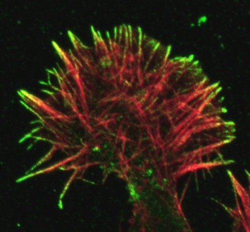 CIL:131, mouse/rat NG108-15, glioma, neuroblastoma