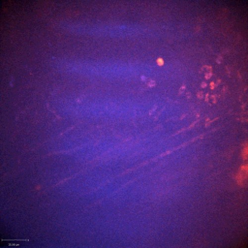 CIL:47557, Staphylococcus aureus, neutrophil, endothelial cell