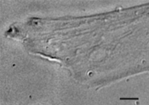 CIL:38603, Homo sapiens, fibroblast