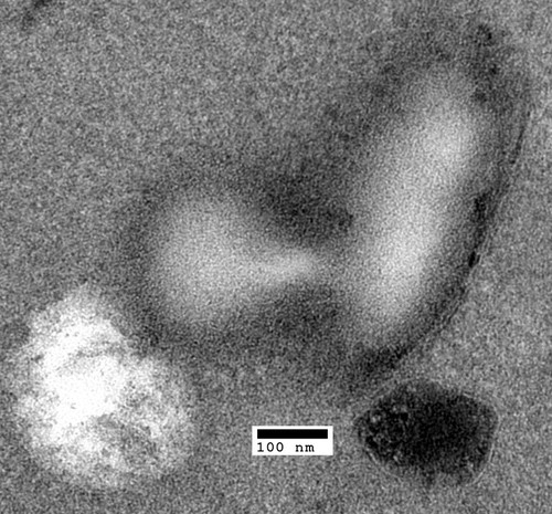 CIL:40427, Saccharomyces cerevisiae, swa2 mutant