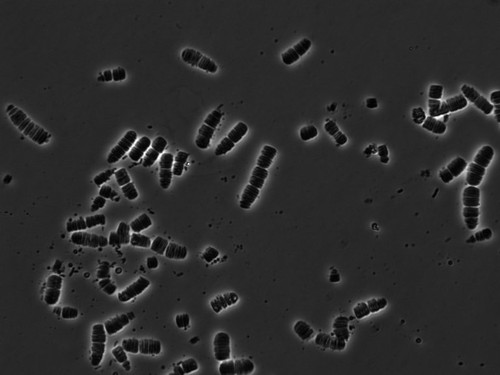 CIL: 54830, Alysiella filiformis, bacteria