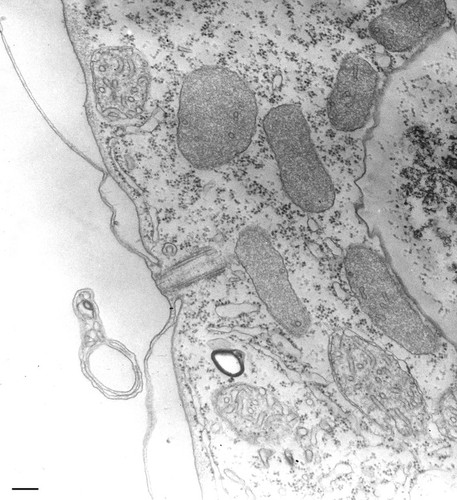 CIL:36215, Tetrahymena pyriformis, cell by organism, eukaryotic cell, Eukaryotic Protist, Ciliated Protist