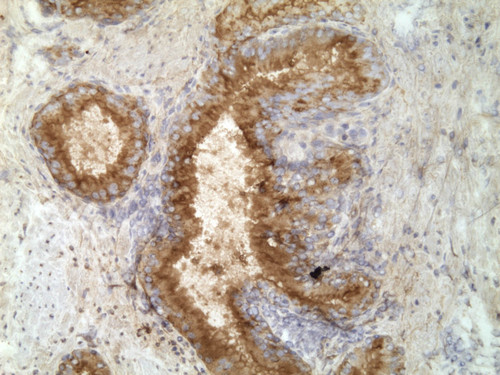 CIL:32217, Homo sapiens, endocrine-paracrine cell of prostate gland, basal cell of prostate epithelium, luminal cell of prostate epithelium, blood vessel endothelial cell, perineural cell, sheath cell, leukocyte, prostate stromal cell, smooth muscle cell of prostate