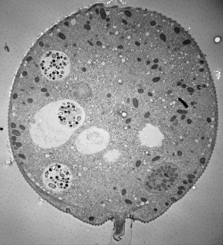 CIL:39406, Vorticella convallaria, cell by organism, eukaryotic cell, Eukaryotic Protist, Ciliated Protist