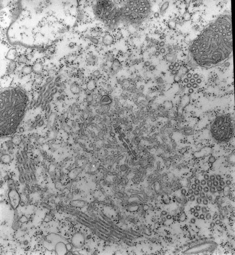 CIL:13096, Paramecium multimicronucleatum, cell by organism, eukaryotic cell, Eukaryotic Protist, Ciliated Protist