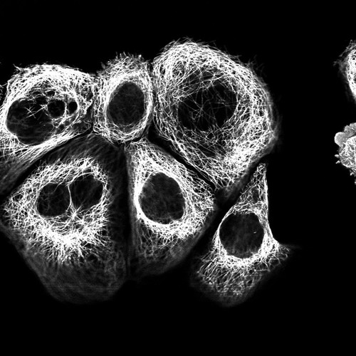 CIL:40486, Homo sapiens, epidermoid carcinoma